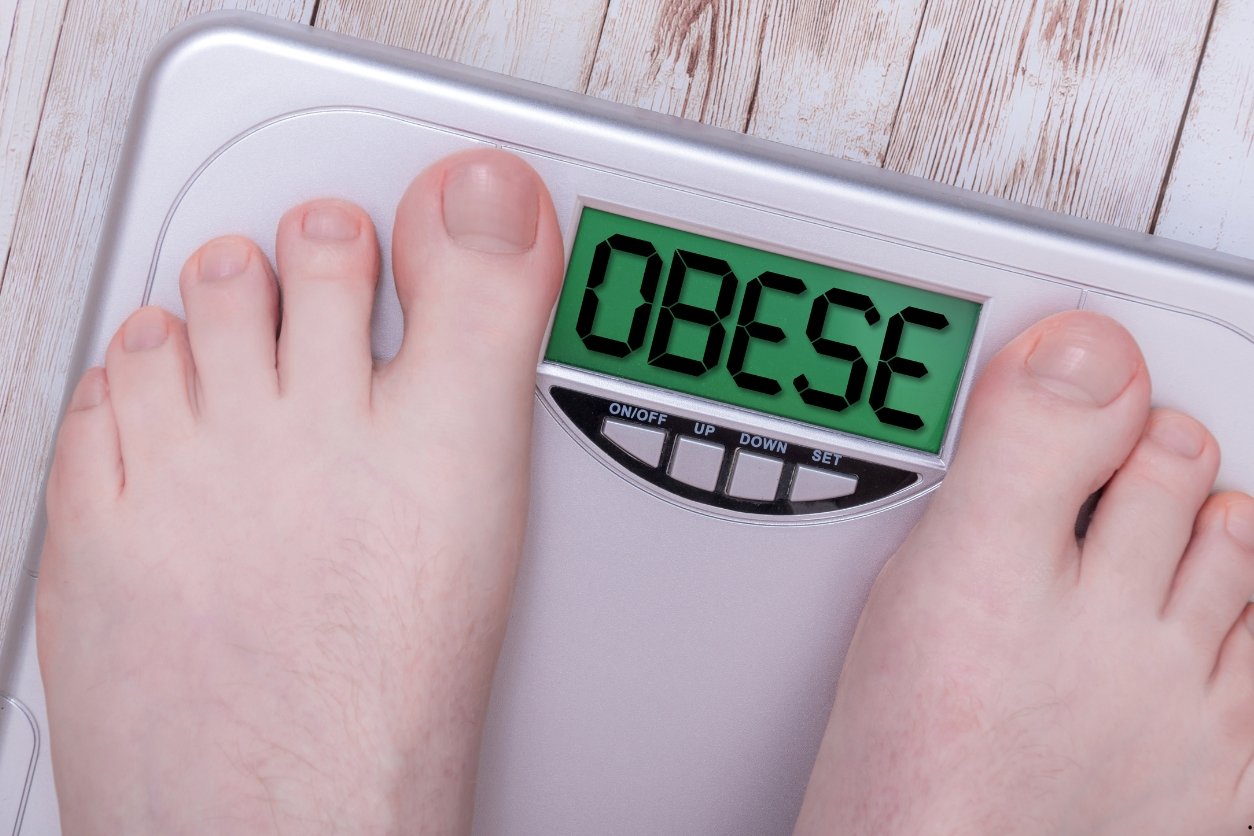 une personne ob&egrave;se