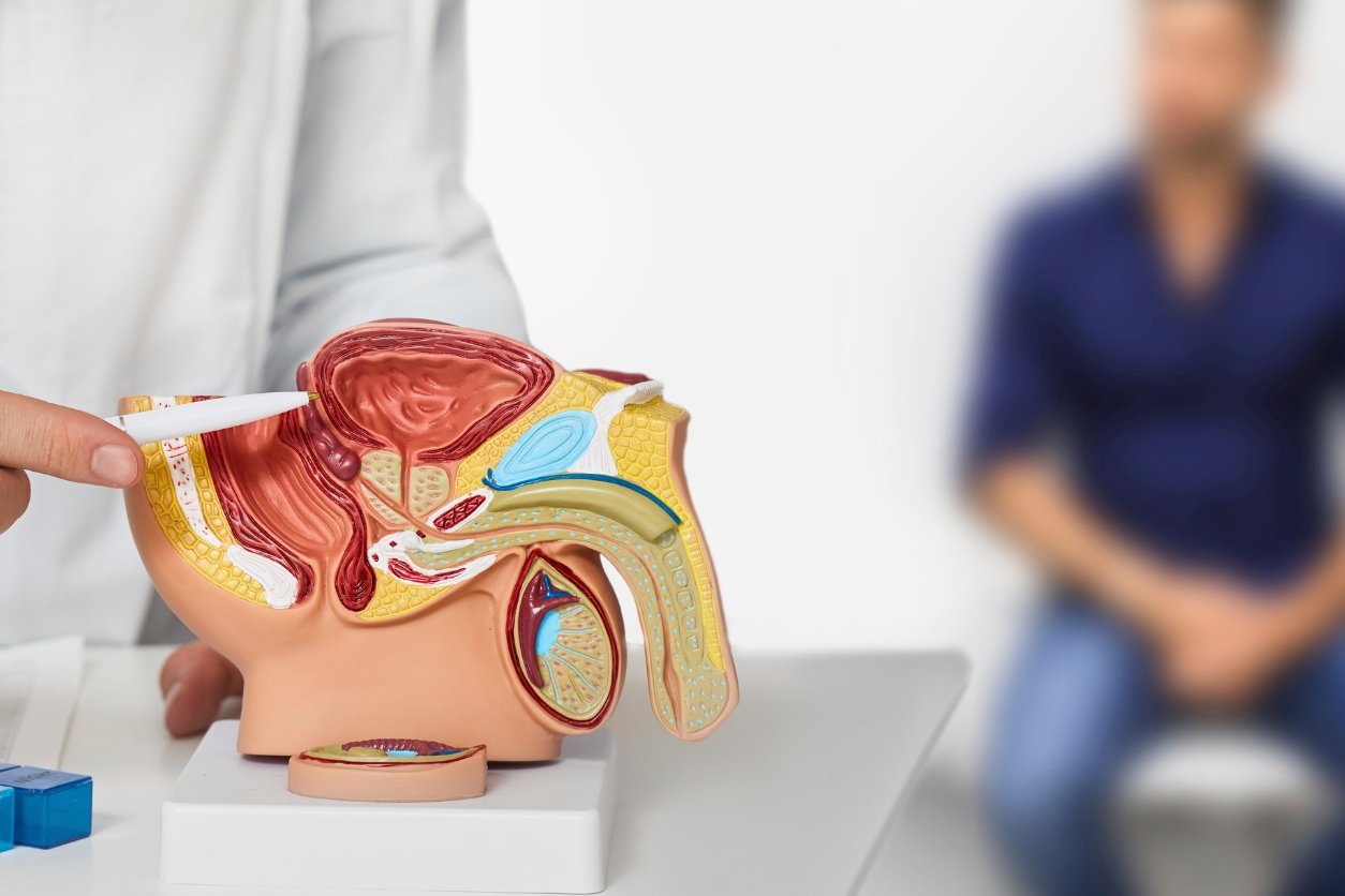 urologue cancer prostate